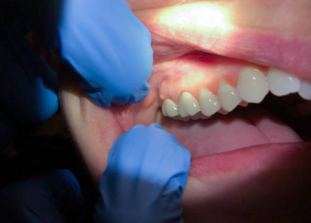 Best Emergency Treatment for Toothache in Council Bluffs, IA